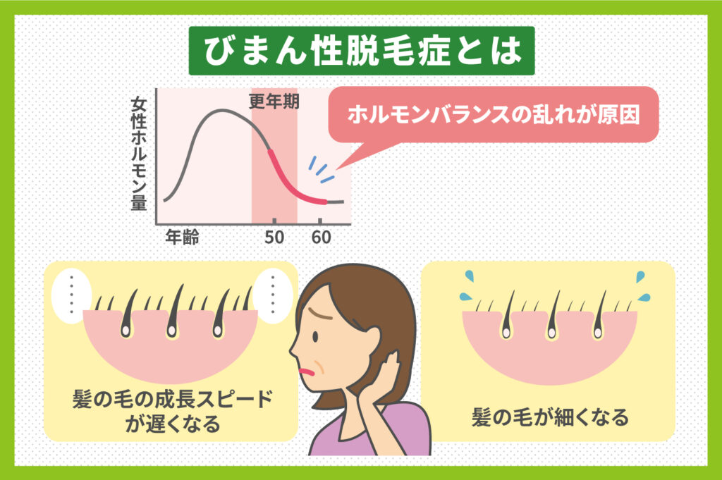 薄毛が気になる50代 60代の女性に似合う髪型とは 蘭夢 公式通販サイト